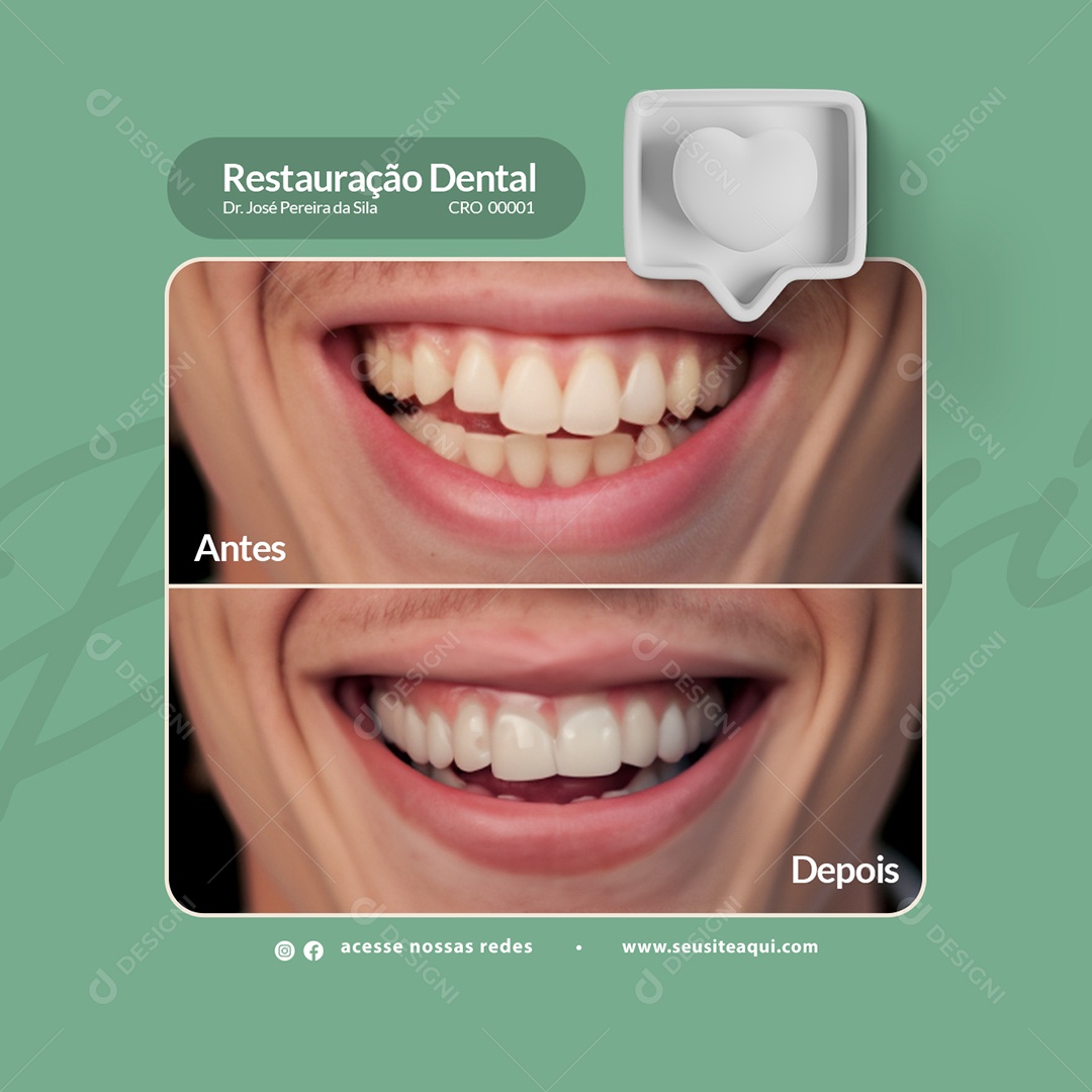 Social Media Clínica Odontológica Restauração Dental Antes Depois PSD Editável