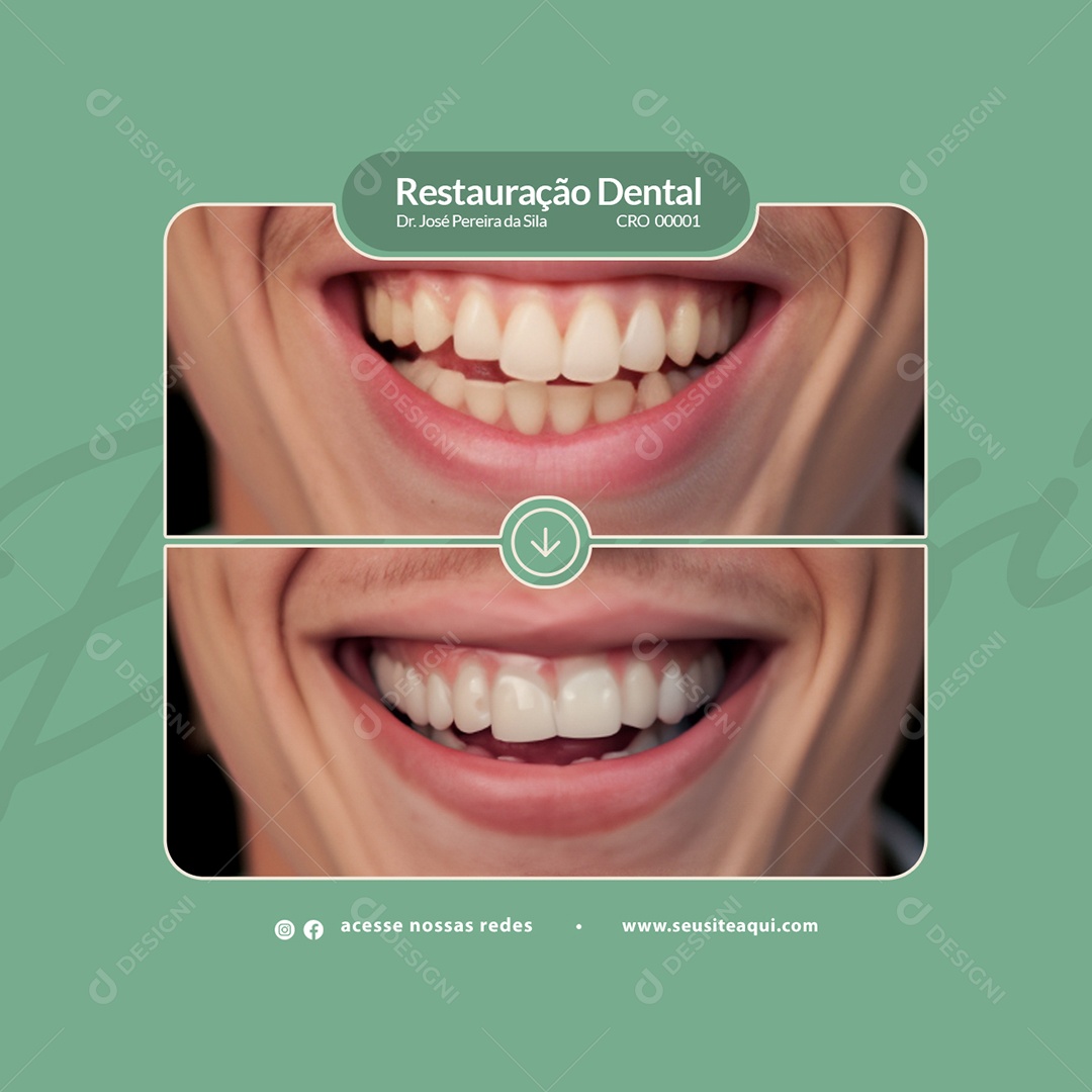 Clínica Odontológica Restauração Dental Social Media PSD Editável