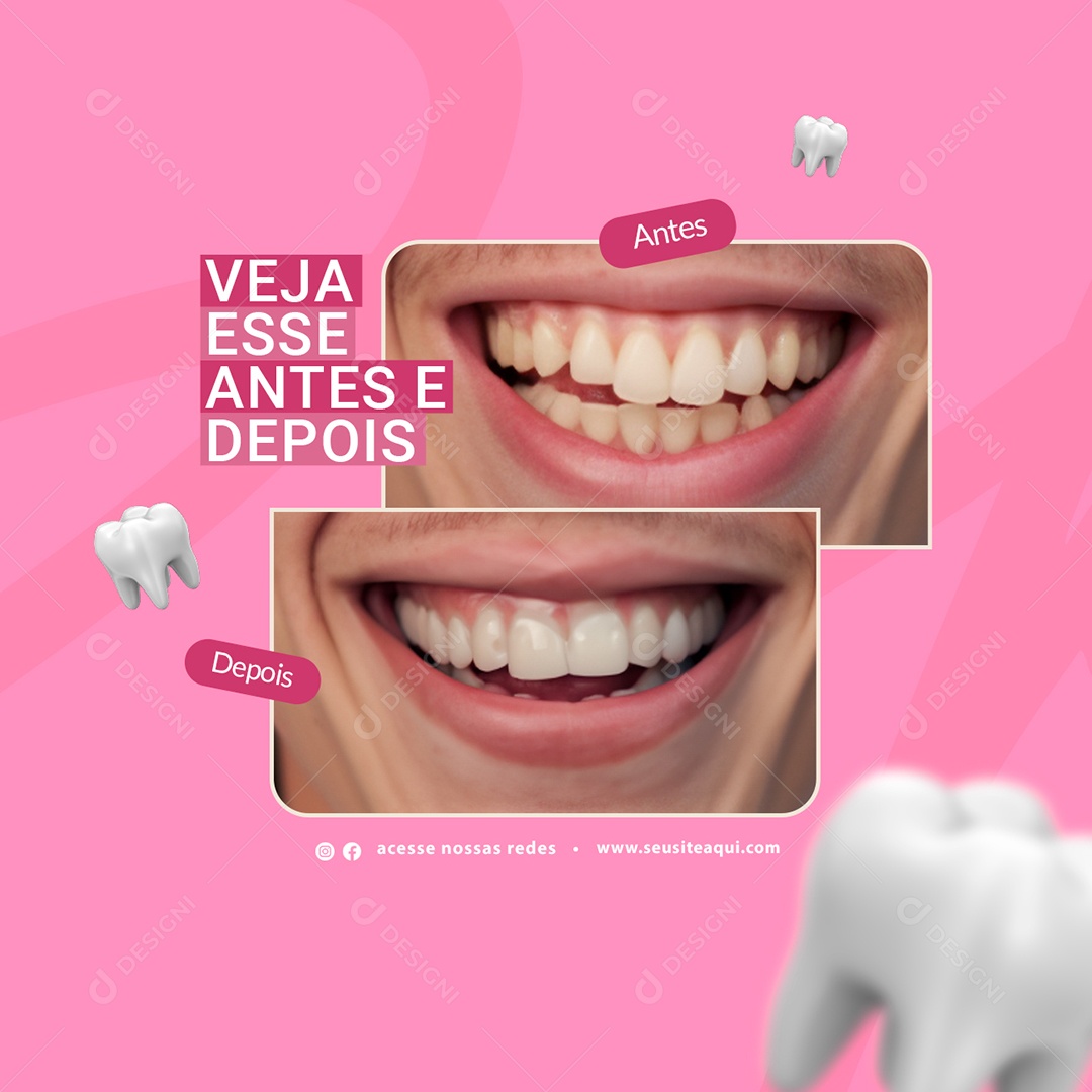 Clínica Odontológica Feedback Veja esse Antes e Depois Social Media PSD Editável