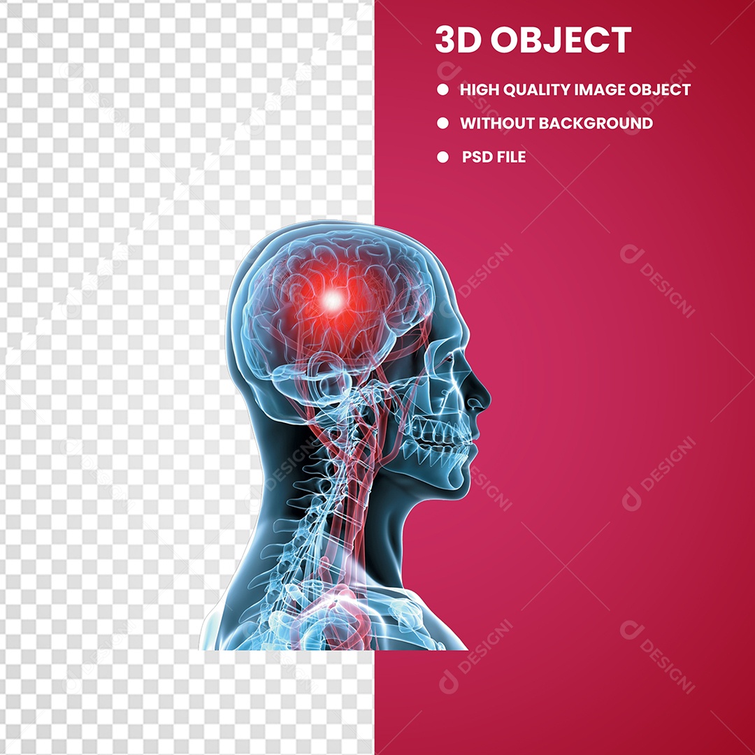 Lesão Cerebral Traumática Nervosa Concussão Elemento 3D Para Composição PSD