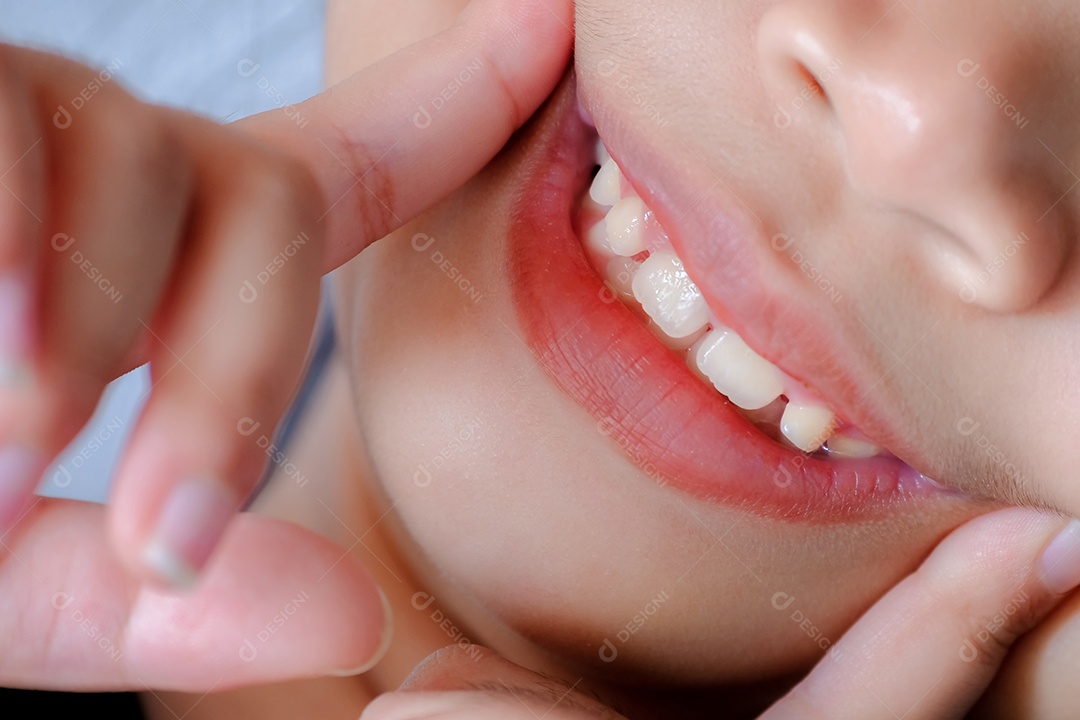 Uma linda garota asiática apontando o dedo no canto da boca com dentes lindo