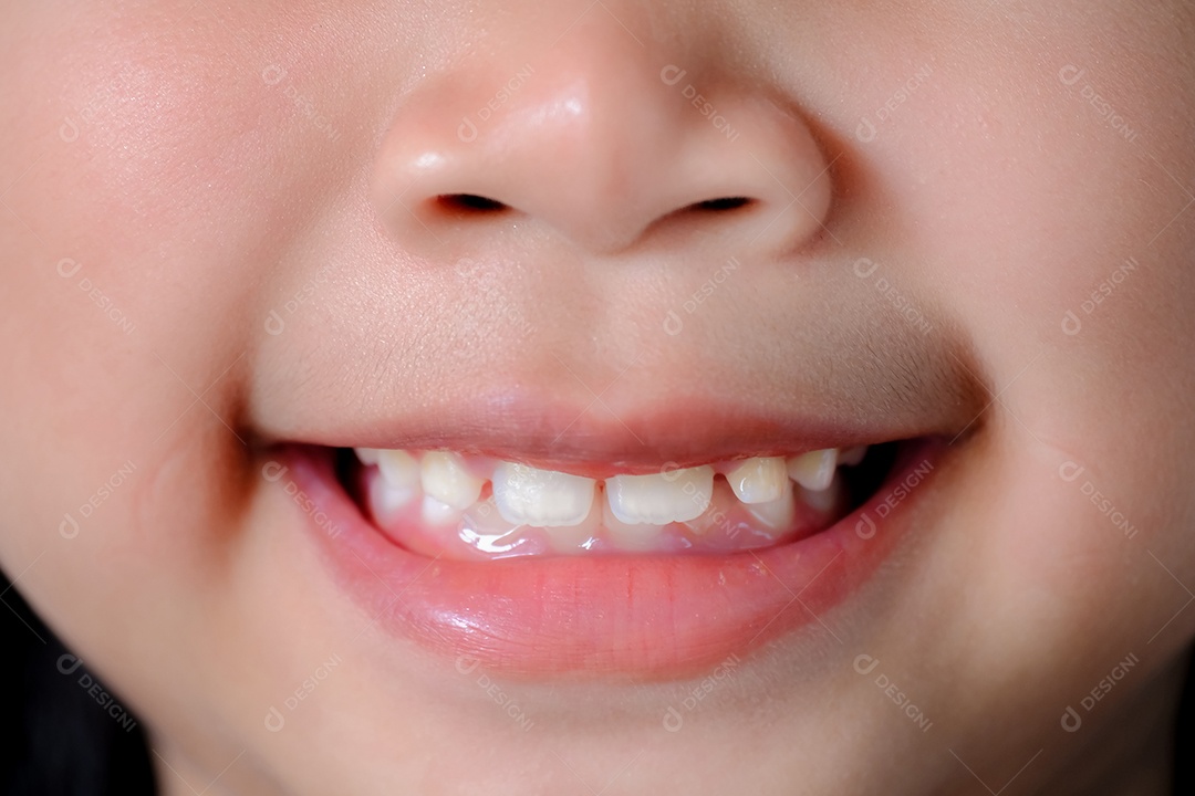 Lindo sorriso de uma criança mostrando dentes cuidados