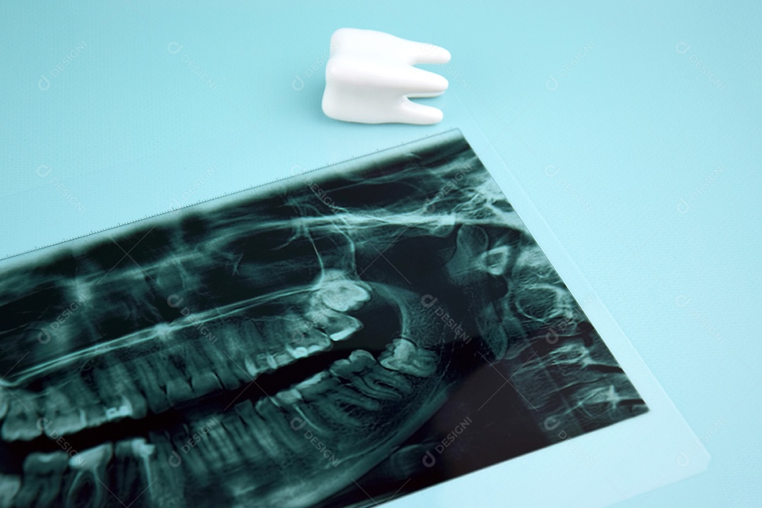 Instantâneo panorâmico da mandíbula do dente do paciente