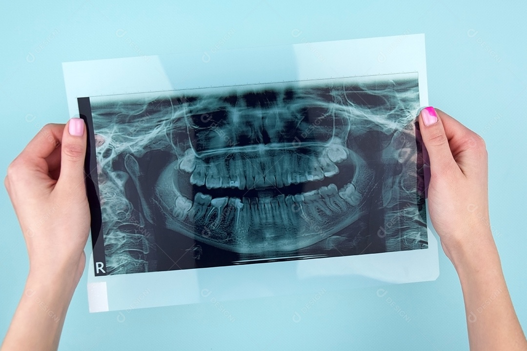 Instantâneo panorâmico da mandíbula do dente do paciente