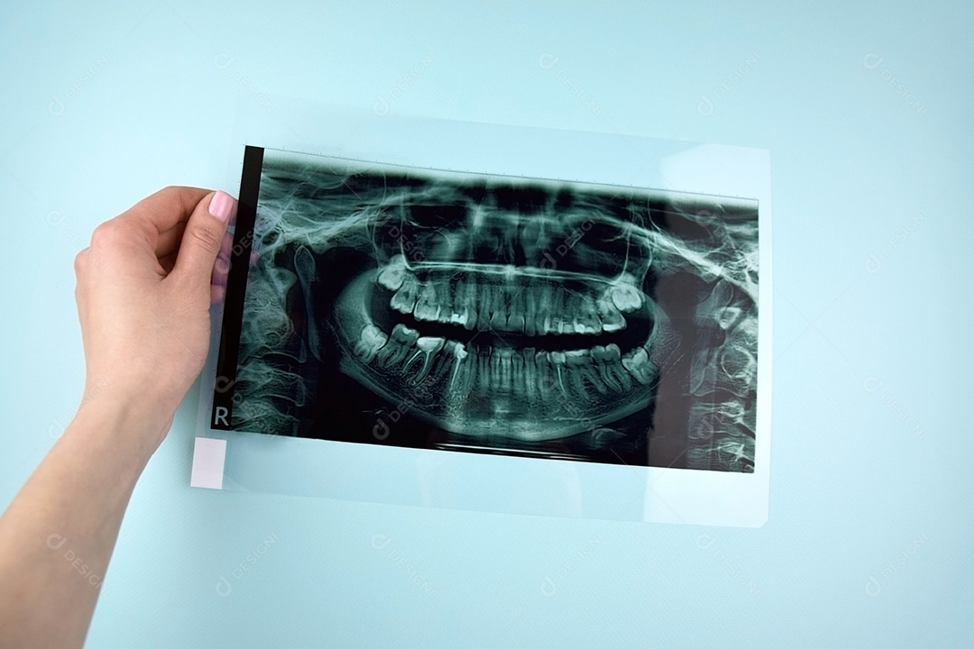 Instantâneo panorâmico da mandíbula do dente do paciente