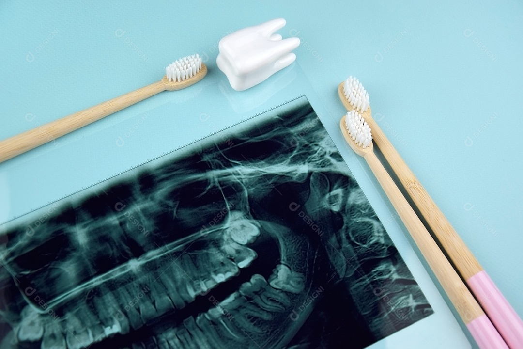 Instantâneo panorâmico da mandíbula do dente do paciente sobre um fundo azul claro