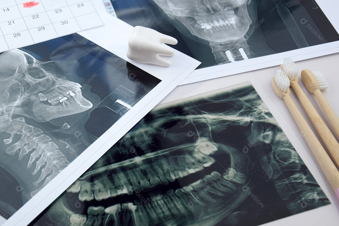 Instantâneo panorâmico da mandíbula do dente do paciente