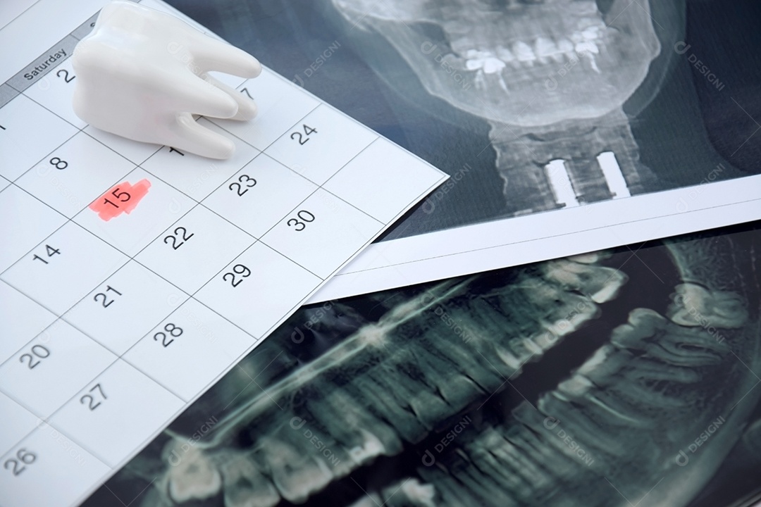 Calendário radiografia e dente de figura de dente