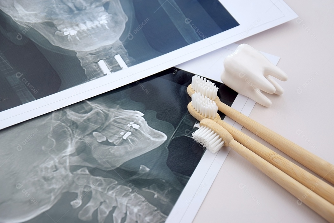 Escovas de dente calendário raio x