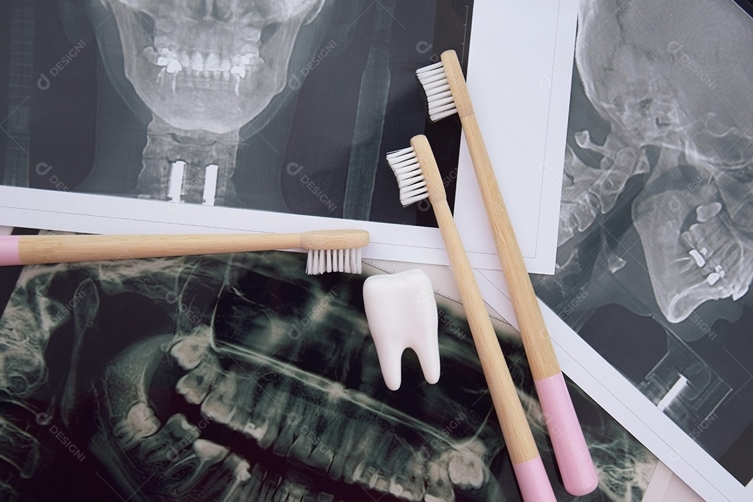 Instantâneo panorâmico da mandíbula do dente do paciente