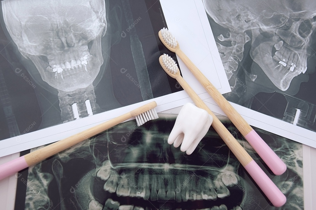 Instantâneo panorâmico da mandíbula do dente do paciente sobre um fundo azul claro