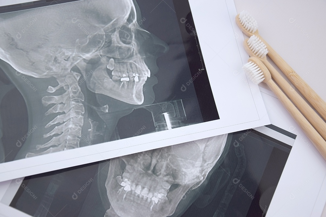 Instantâneo panorâmico da mandíbula do dente do paciente