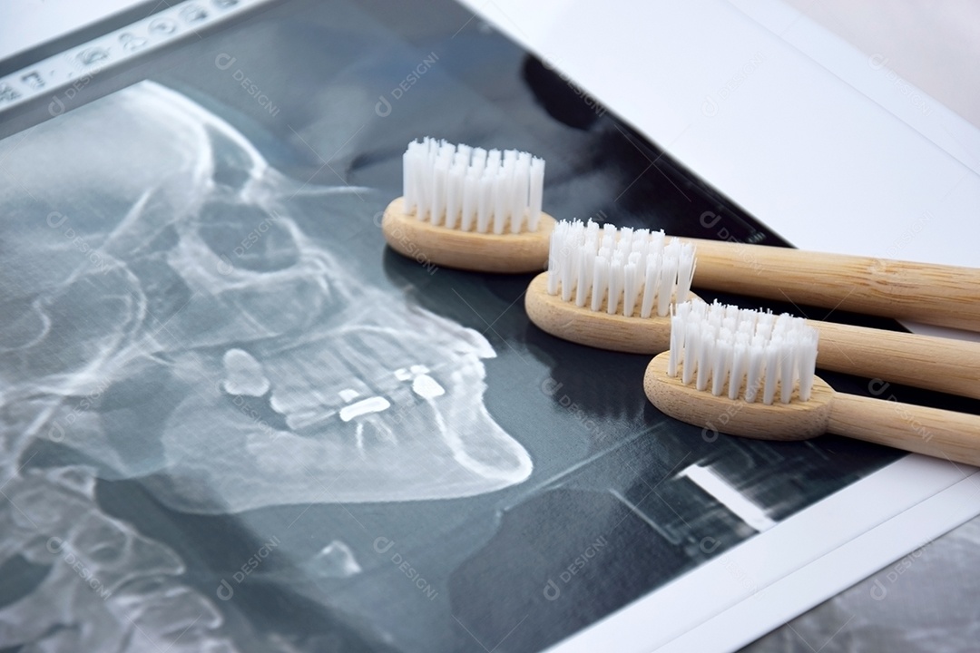 Instantâneo panorâmico da mandíbula do dente do paciente e três escovas de dente