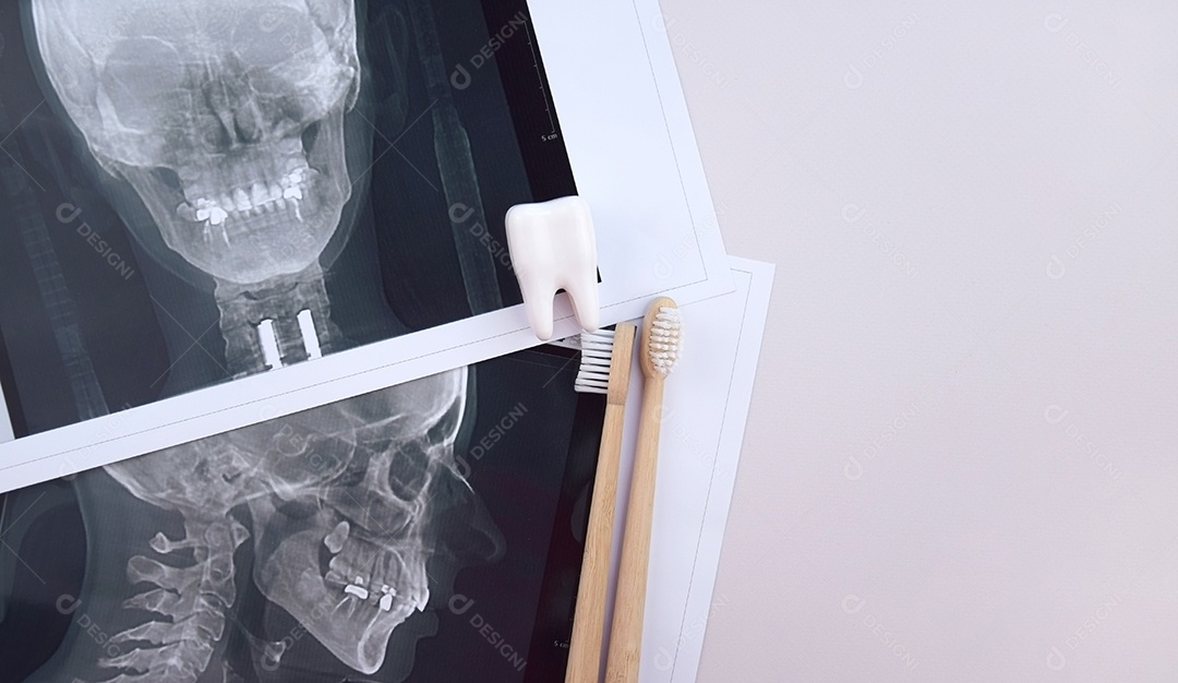 Instantâneo panorâmico da mandíbula do dente do paciente