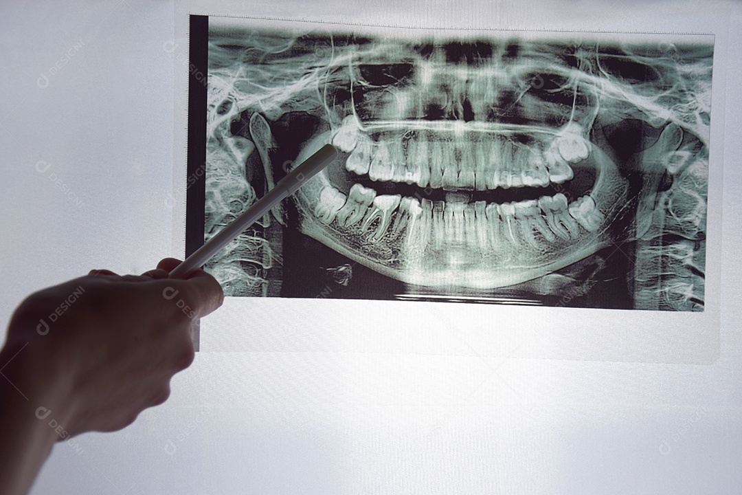 Instantâneo panorâmico da mandíbula do dente do paciente