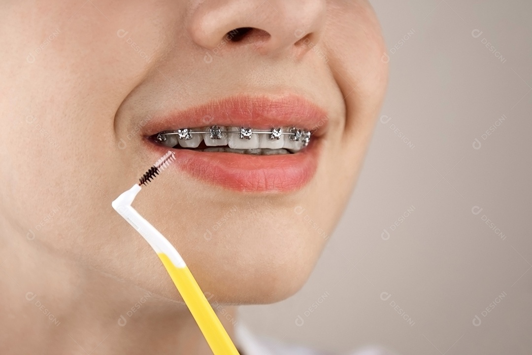 Retrato de uma jovem com aparelho