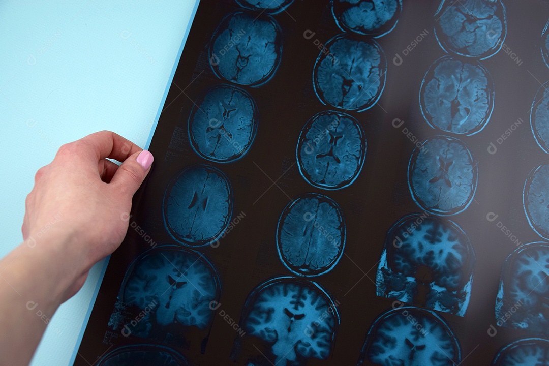 O resultado da ressonância magnética do cérebro humano