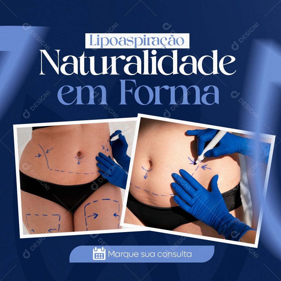 Clínica Estética Lipoaspiração Naturalidade em Forma Social Media PSD Editável