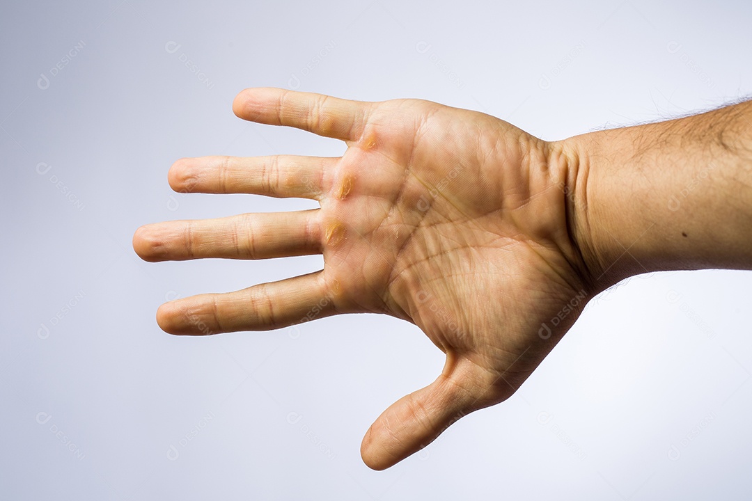 Mão aberta sobre fundo branco
