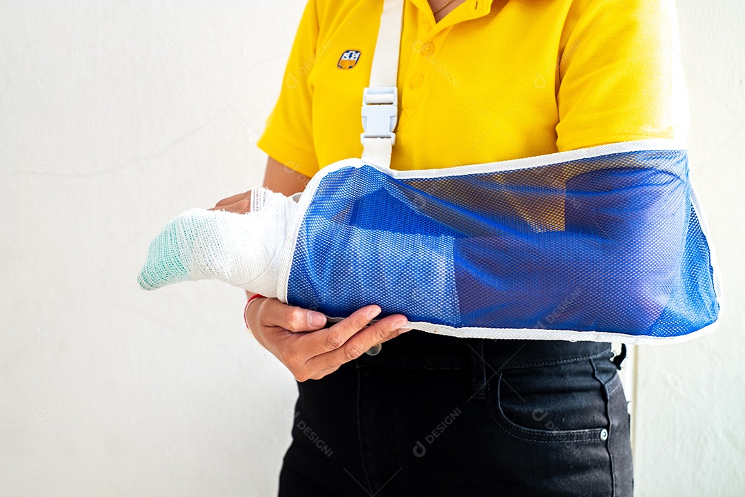 Uma jovem usando tipoia com braço machucado