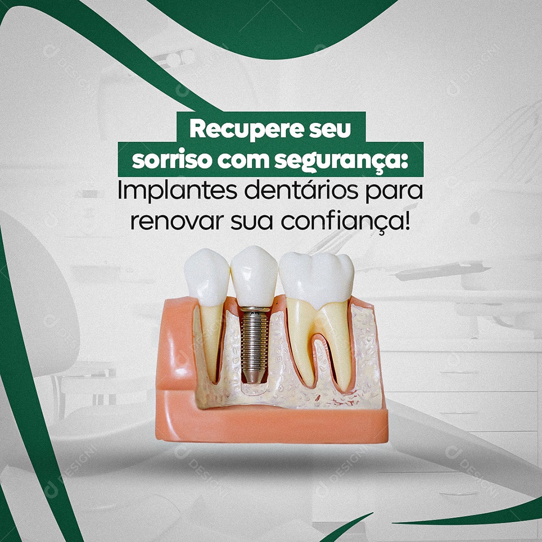 Dentista Recupere seu Sorriso Implante Dentários Social Media PSD Editável