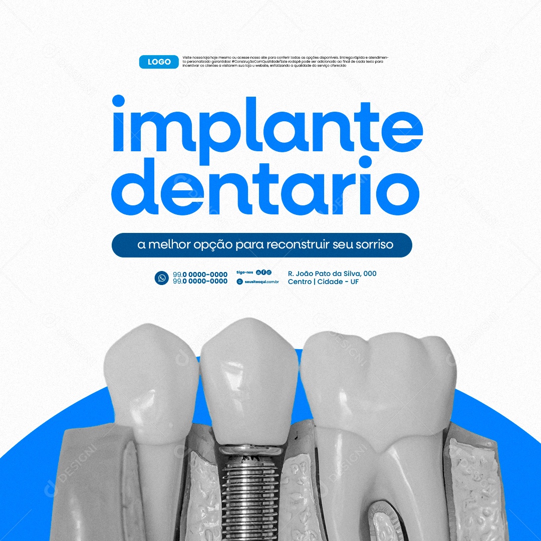 Dentista Implante Dentario a Melhor Opção para Reconstruir seu Sorriso Social Media PSD Editável