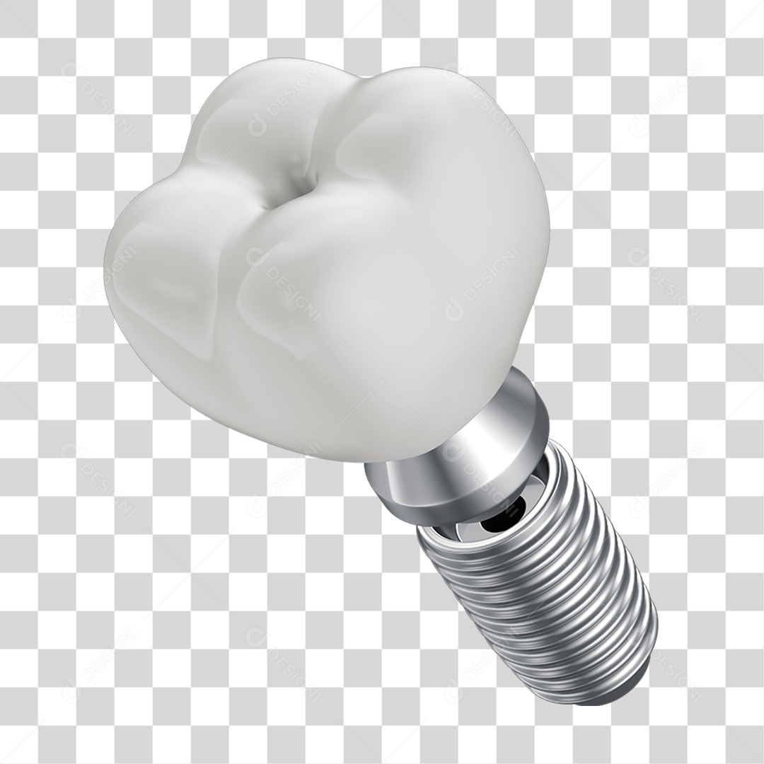 Elemento 3D Dente Branco Para Implante PNG Transparente