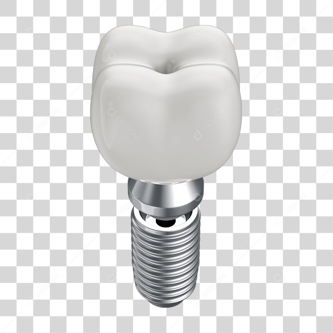Elemento 3D Dente Branco Para Implante PNG Transparente