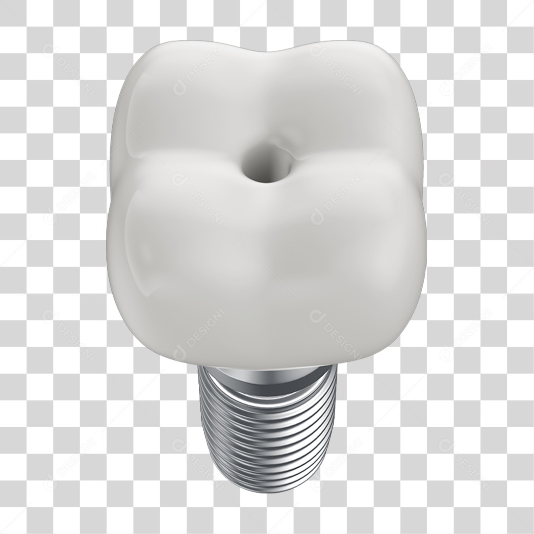 Elemento 3D Dente Branco Para Implante PNG Transparente
