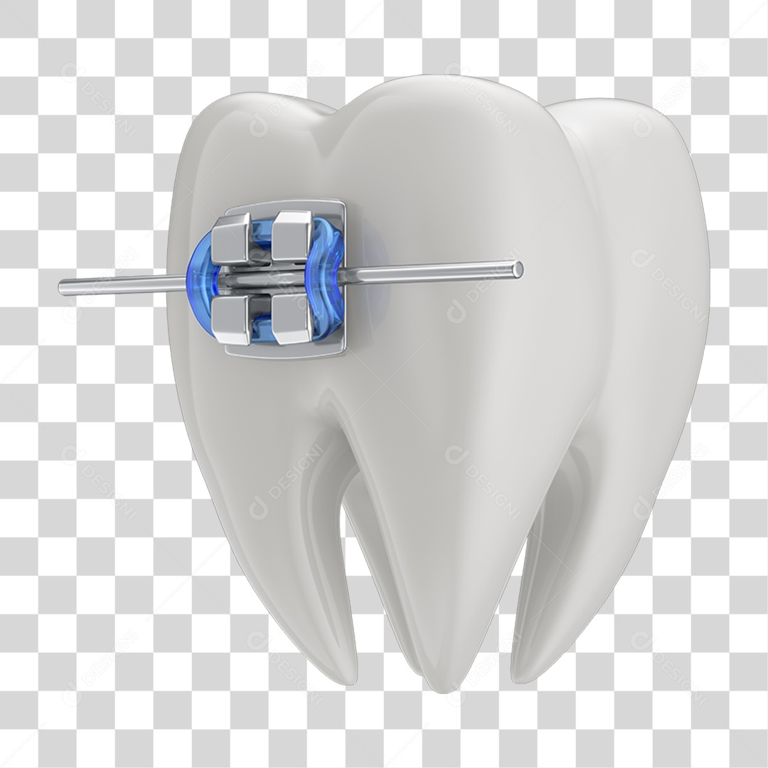 Dente Branco com Aparelho PNG Transparente