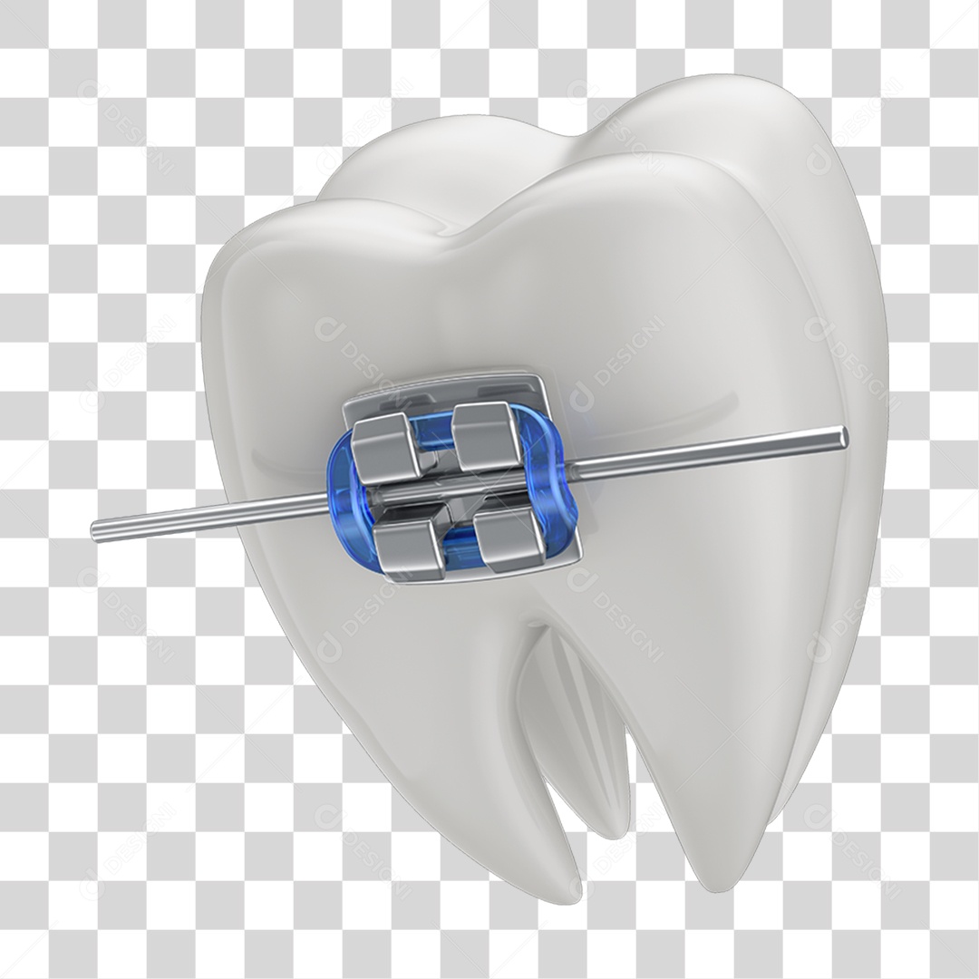 Dente Branco com Aparelho PNG Transparente
