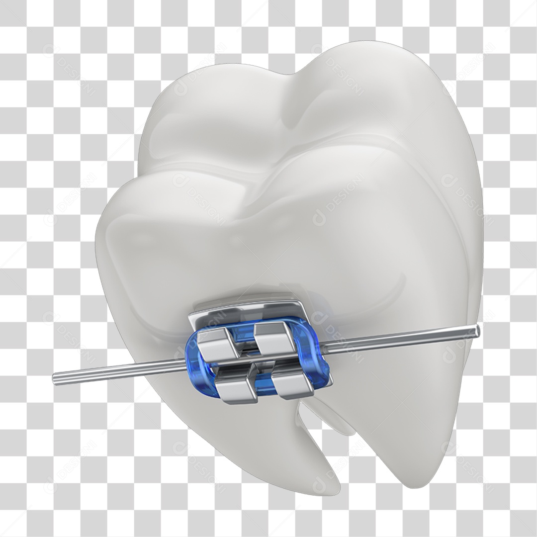 Dente Branco com Aparelho PNG Transparente