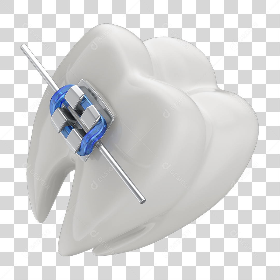 Dente Branco com Aparelho PNG Transparente
