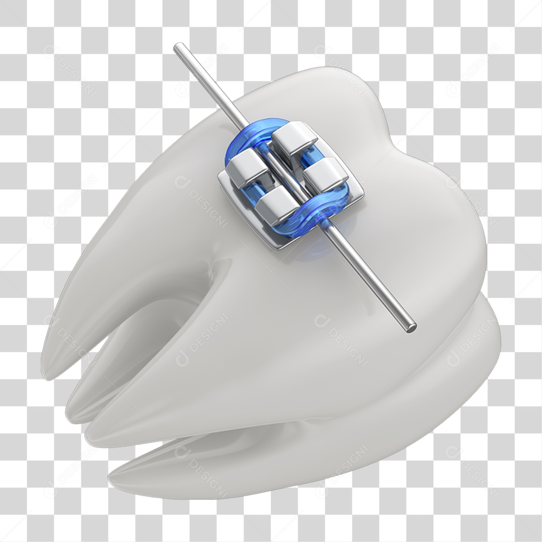 Dente Branco com Aparelho PNG Transparente