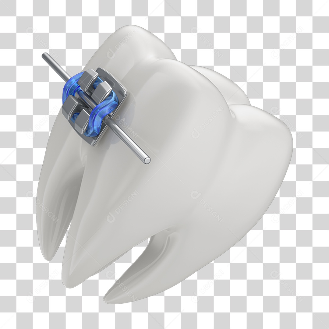 Dente Branco com Aparelho PNG Transparente