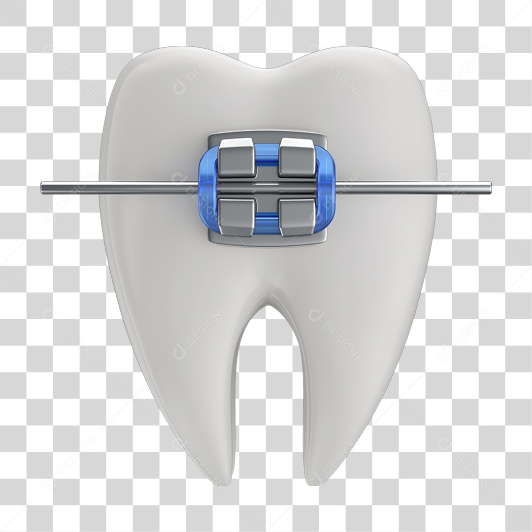 Dente Branco com Aparelho PNG Transparente