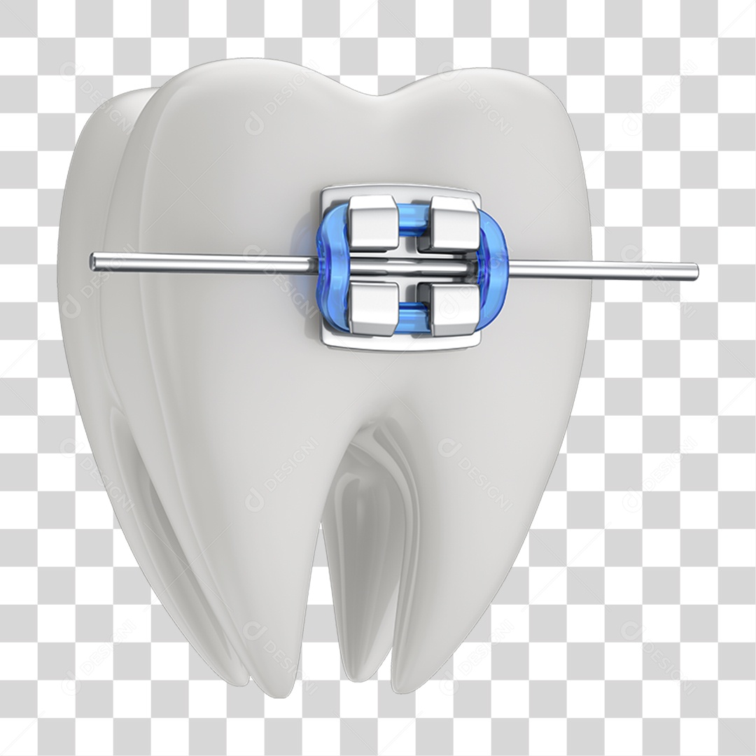 Dente Branco com Aparelho PNG Transparente