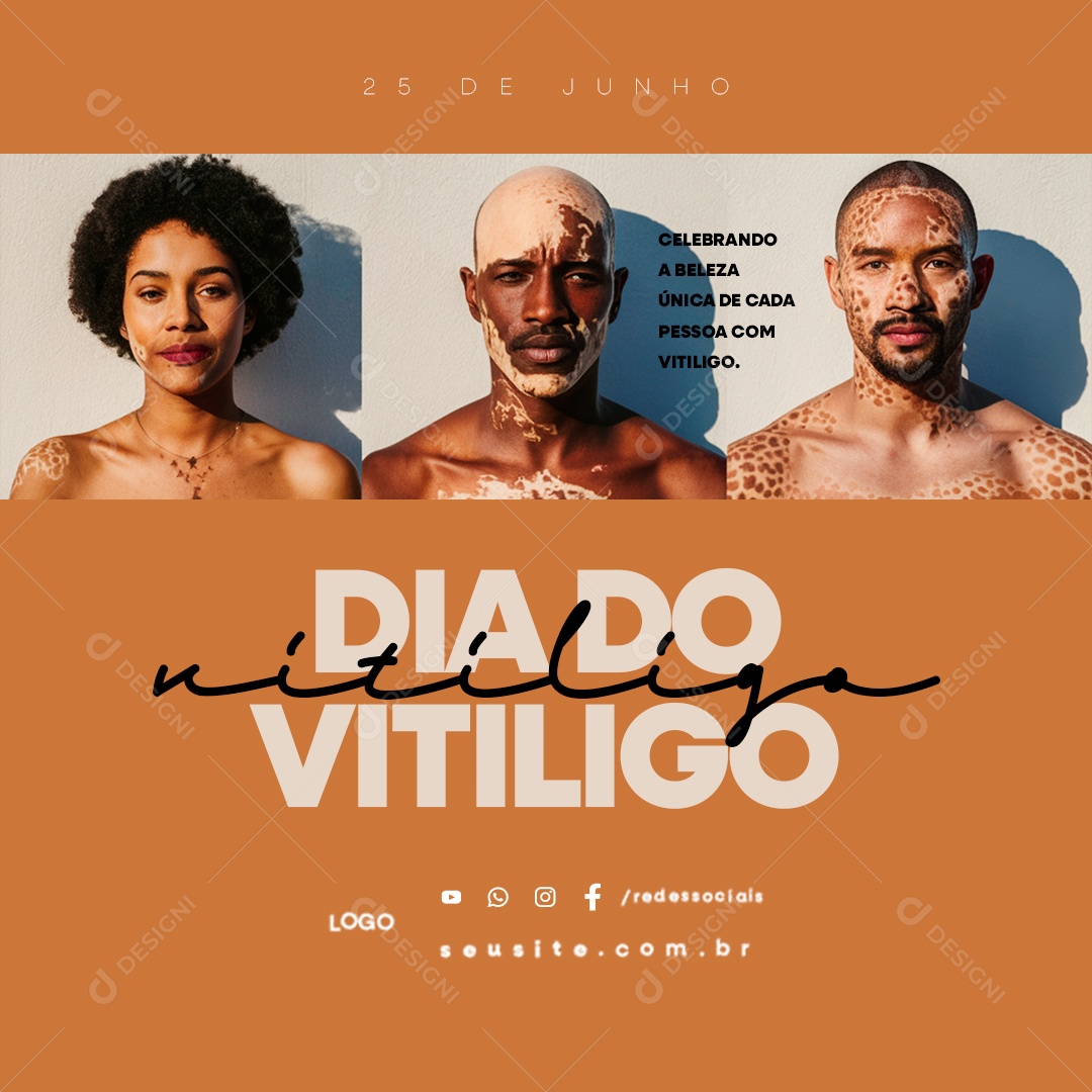 Dia Mundial do Vitiligo 25 de Junho Celebrando a Beleza Única de Cada Pessoa Social Media PSD Editável