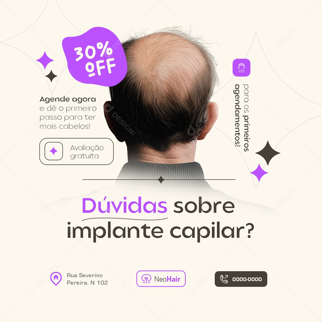 Dúvidas Sobre Implante Capilar Social Media PSD Editável
