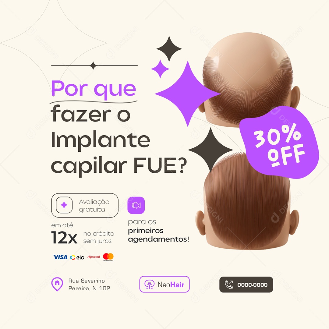Por Que Fazer o Implante Capilar Social Media PSD Editável