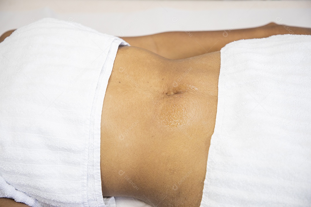 Tratamento estético para corpo