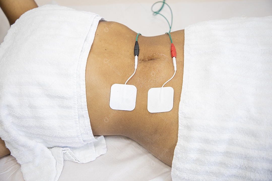 Mulher fazendo protocolo de gordura localizada