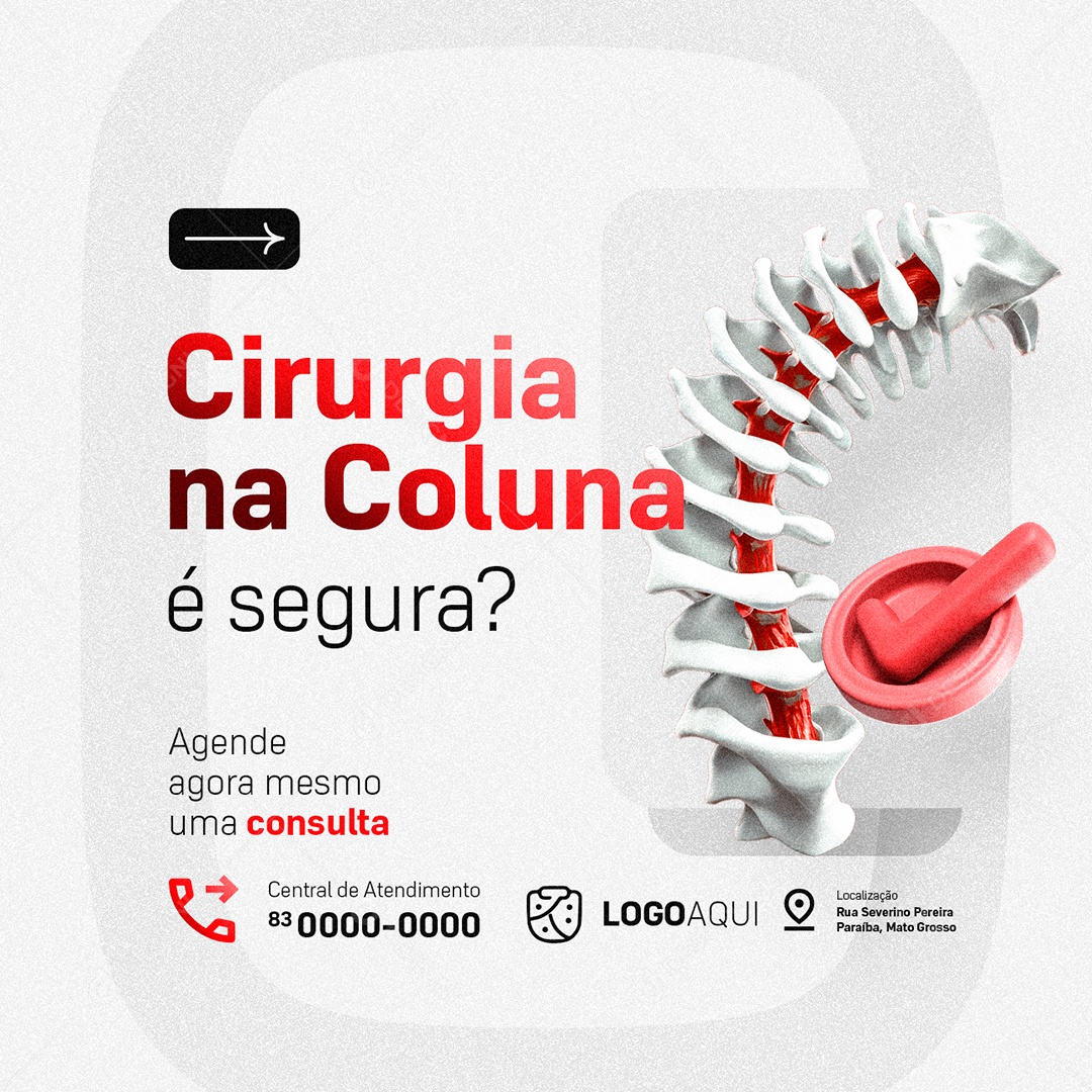 Ortopedista Cirurgia na Coluna é Segura Social Media PSD Editável