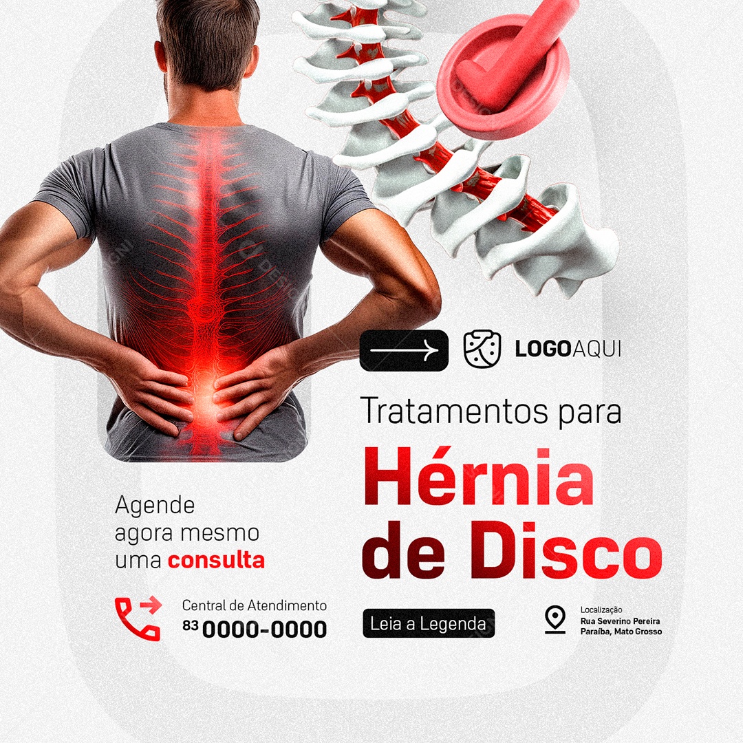 Ortopedista Hérnia de Disco Social Media PSD Editável