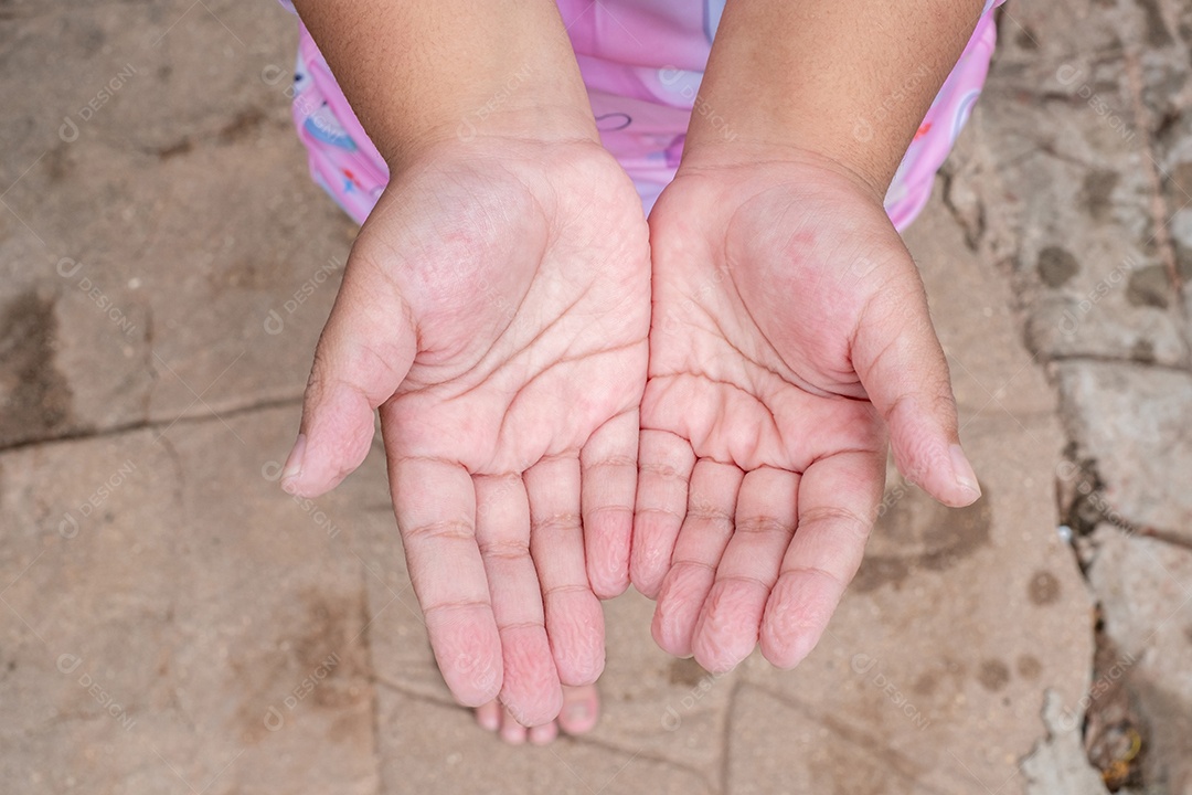 Mãos de uma garotinha depois de um dia de piscina