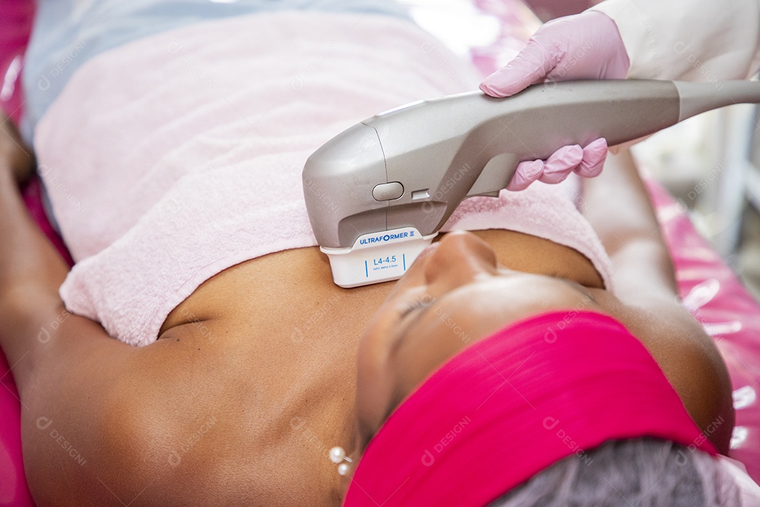 Protocolo estético nas axilas