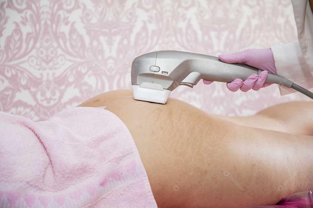 Mulher fazendo procedimento estético