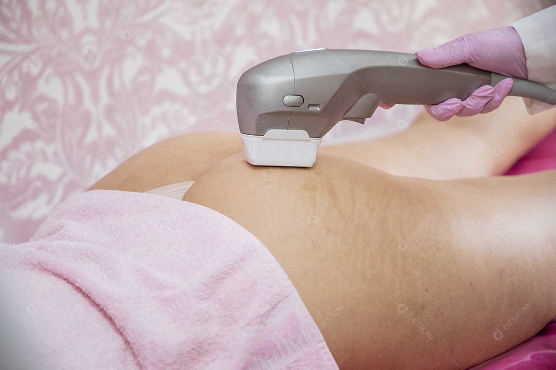 Mulher fazendo procedimento estético