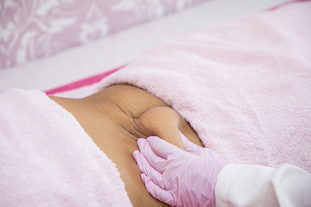 Procedimento estético para gordura localizada