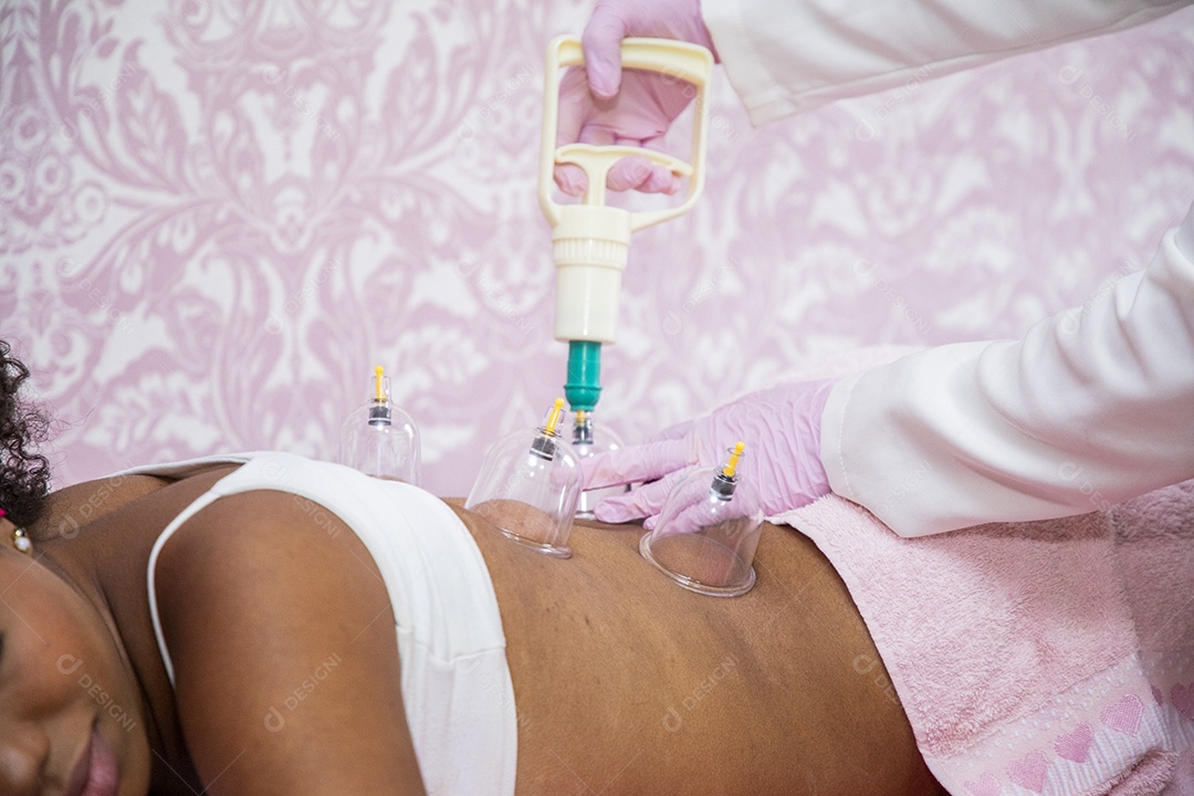 Procedimento de ventosa terapia em clínica estética